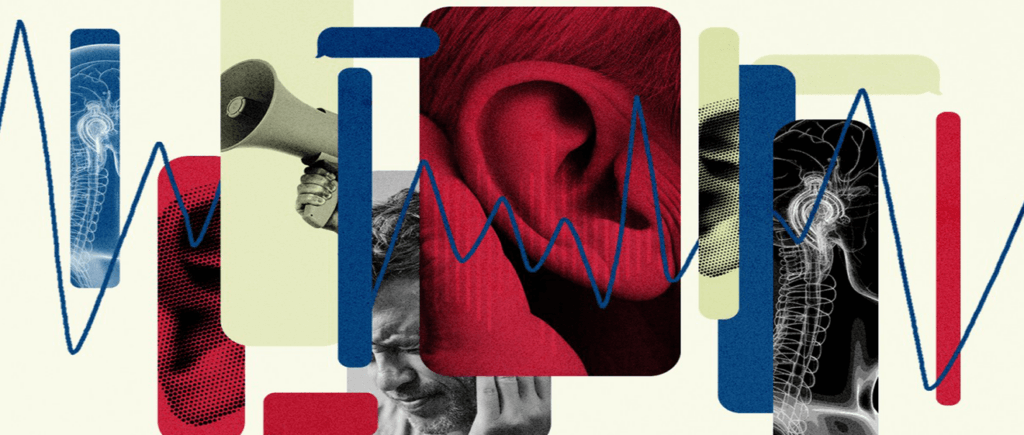 Infographic about tinnitus 